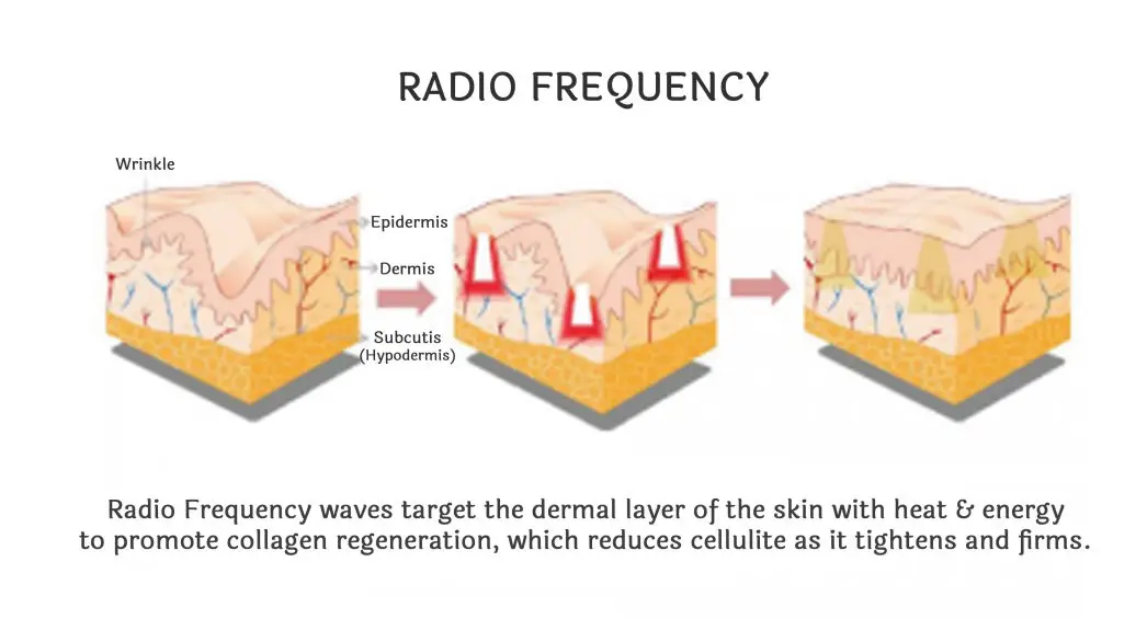 Radio Frequency RF